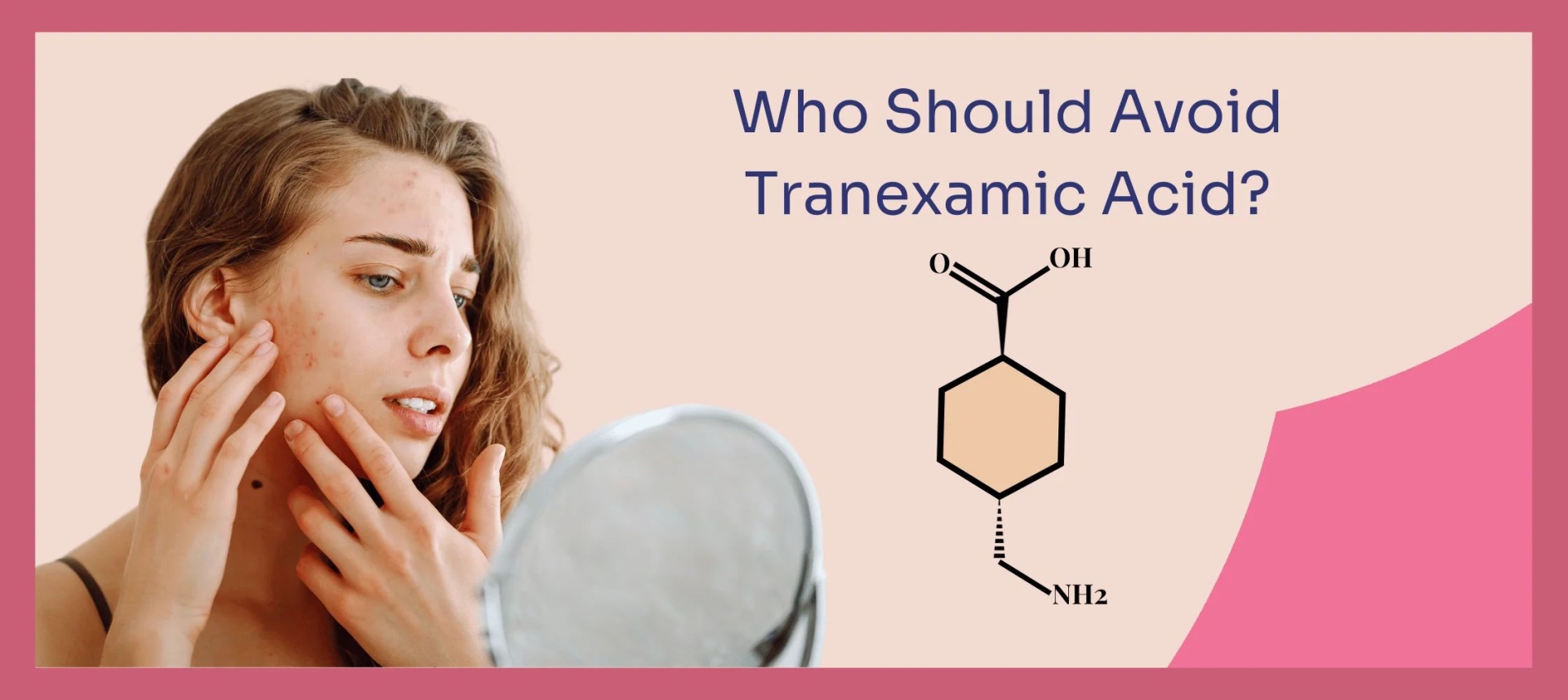 网红“氨甲环酸”被批准用于色斑治疗了吗？